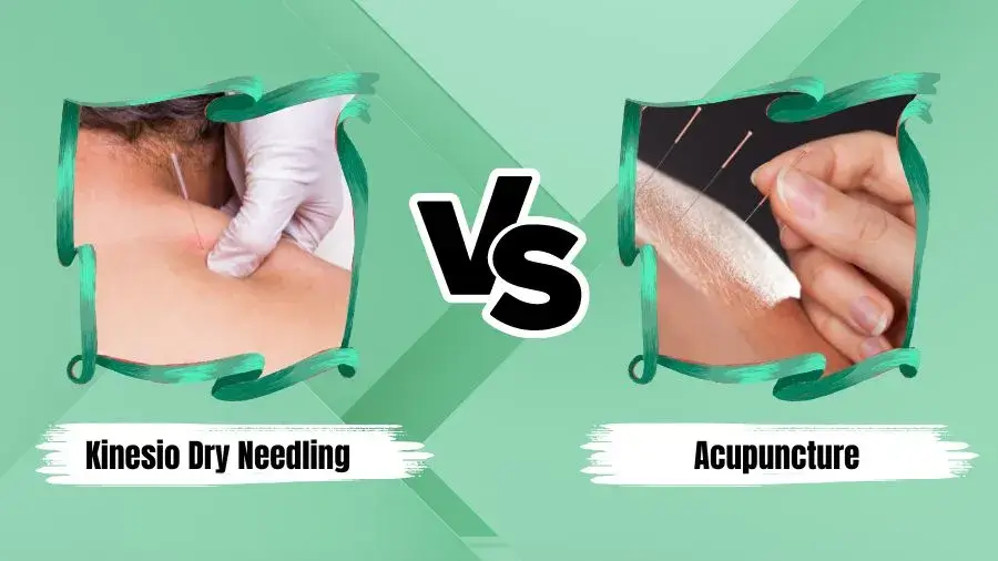 Kinesio-Dry-needling-VS-Acupuncture