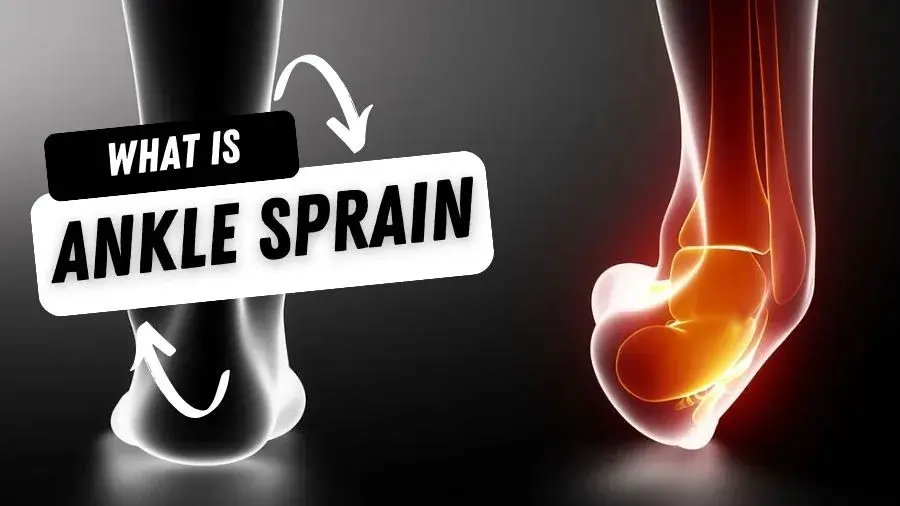 What is Ankle Sprain?